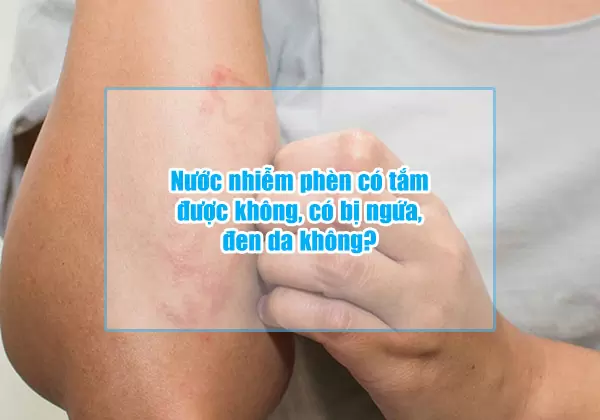 Nước nhiễm phèn có tắm được không, có bị ngứa, đen da không? 8 nuoc nhiem phen co tam duoc khong co bi ngua den da khong